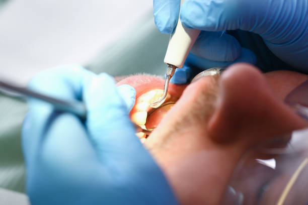Best Broken or Cracked Tooth Emergency Dentist in Alto, TX